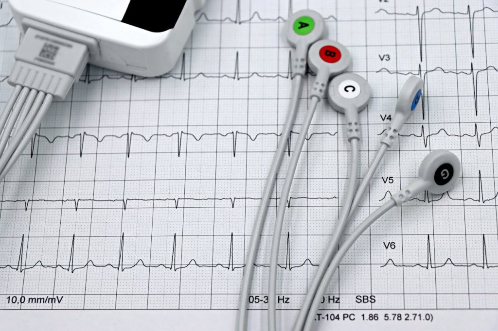 Dove fare elettrocardiogramma a Vaiano Dove fare elettrocardiogramma a Vaiano